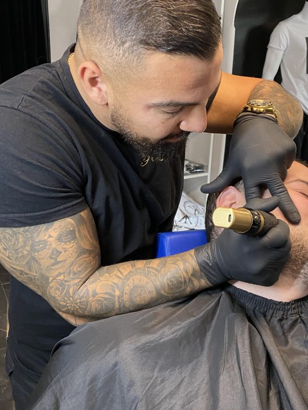 Scalp micropigmentation