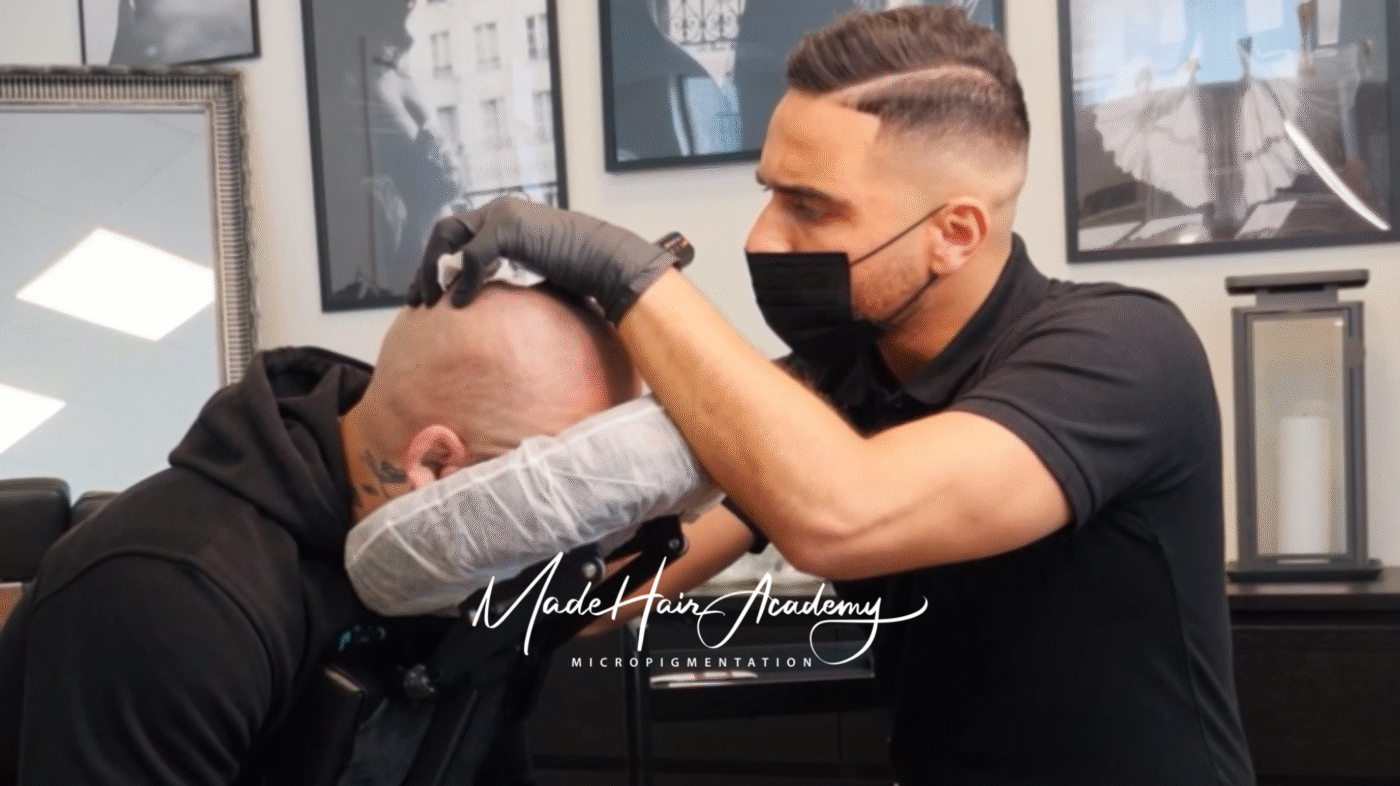 scalp-micropigmentation-for-man-goteborg-made-hair-academy.jpg
