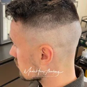 Pigmenteringsbehandling på man, 34 år, utförd hos Made Hair Academy i Göteborg – ledande klinik för diskret hårtatuering i Sverige