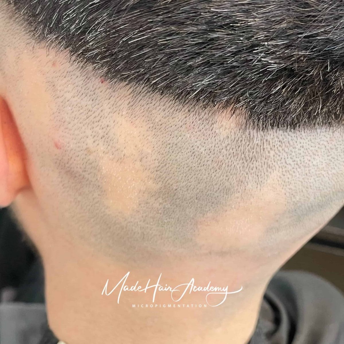 Pigmenteringsbehandling på man, 34 år, utförd hos Made Hair Academy i Göteborg – ledande klinik för diskret hårtatuering i Sverige