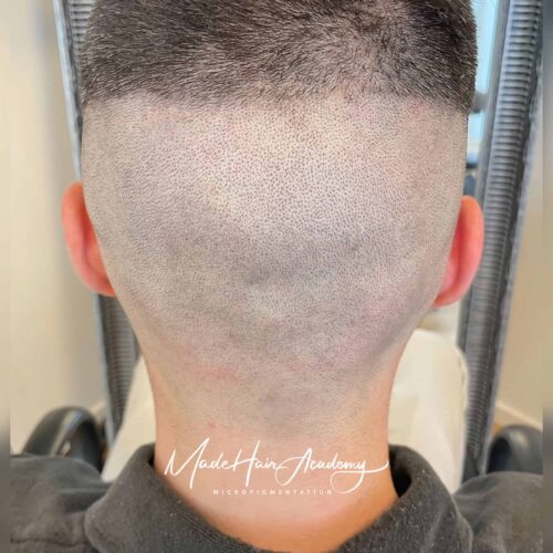 SMP prickpigmentering på man, 27 år, utförd hos Made Hair Academy i Göteborg – ledande klinik för diskret hårtatuering i Sverige