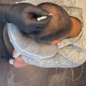 Tatuera hårbotten Priser och paket för SMP utbildning | Made Hair Academy Sverige. Sveriges bästa smp studio