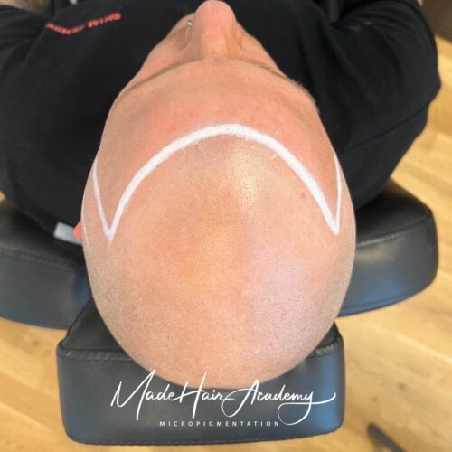 Naturlig och diskret hårpigmentering för man, 38 år, utförd hos Made Hair Academy i Göteborg – ledande klinik för diskret hårtatuering i Sverige