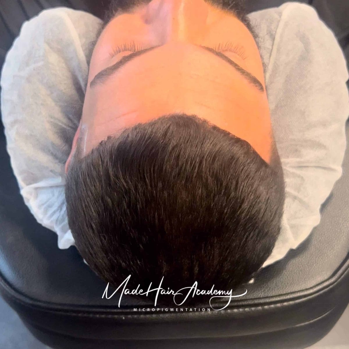Hårbotten-tatuering på man, 33 år, utförd hos Made Hair Academy i Göteborg – ledande klinik för diskret hårtatuering i Sverige