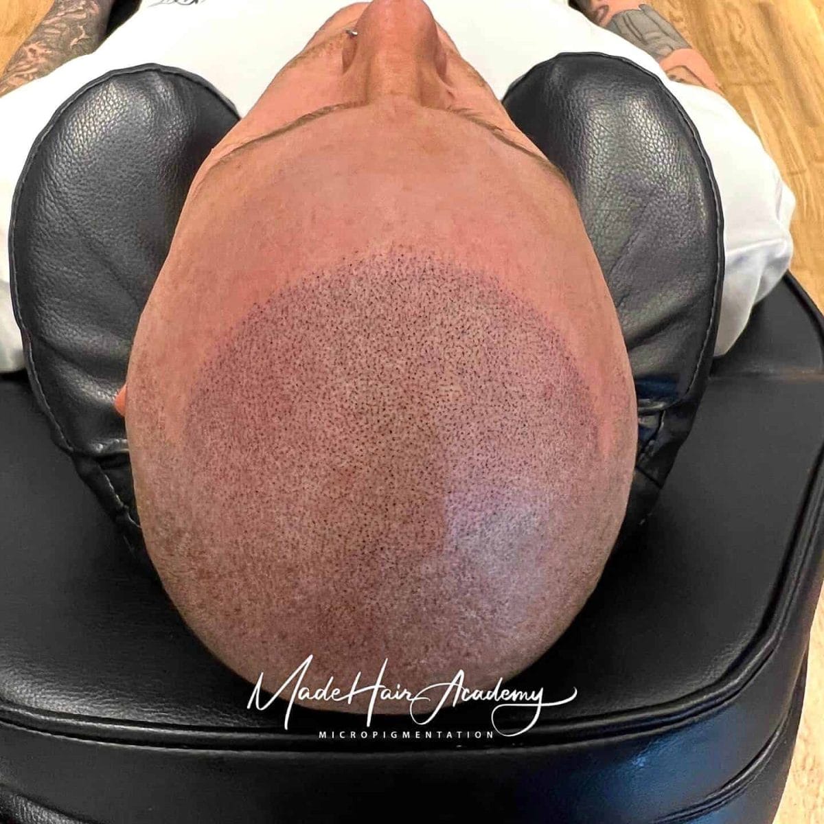 Hårbotten tatuering på man, 35 år, utförd hos Made Hair Academy i Stockholm – ledande klinik för diskret hårtatuering i Sverige