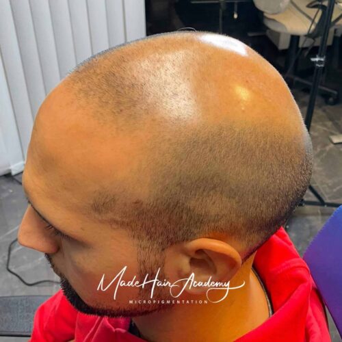 Hårlinje-pigmentering för man hårlinje i Stockholm utförd hos Made Hair Academy – ledande klinik inom hårpigmentering i Sverige