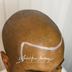 Scalp Micropigmentation, Hårpigmentering - Naturlig hårlinje med smp på man, 28 år, i Göteborg – Naturligt resultat från Made Hair Academy.