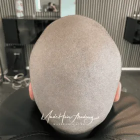 Scalp Micropigmentation, Hårpigmentering - Naturlig hårlinje med smp på man, 33 år, i Stockholm – Naturligt resultat från Made Hair Academy.