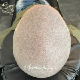 Hårpigmentering och diskret hårtatuering på man, 39 år, hos Made Hair Academy i Stockholm – ledande klinik för diskret hårtatuering i Sverige