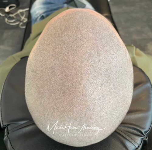 Hårpigmentering och diskret hårtatuering på man, 39 år, hos Made Hair Academy i Stockholm – ledande klinik för diskret hårtatuering i Sverige