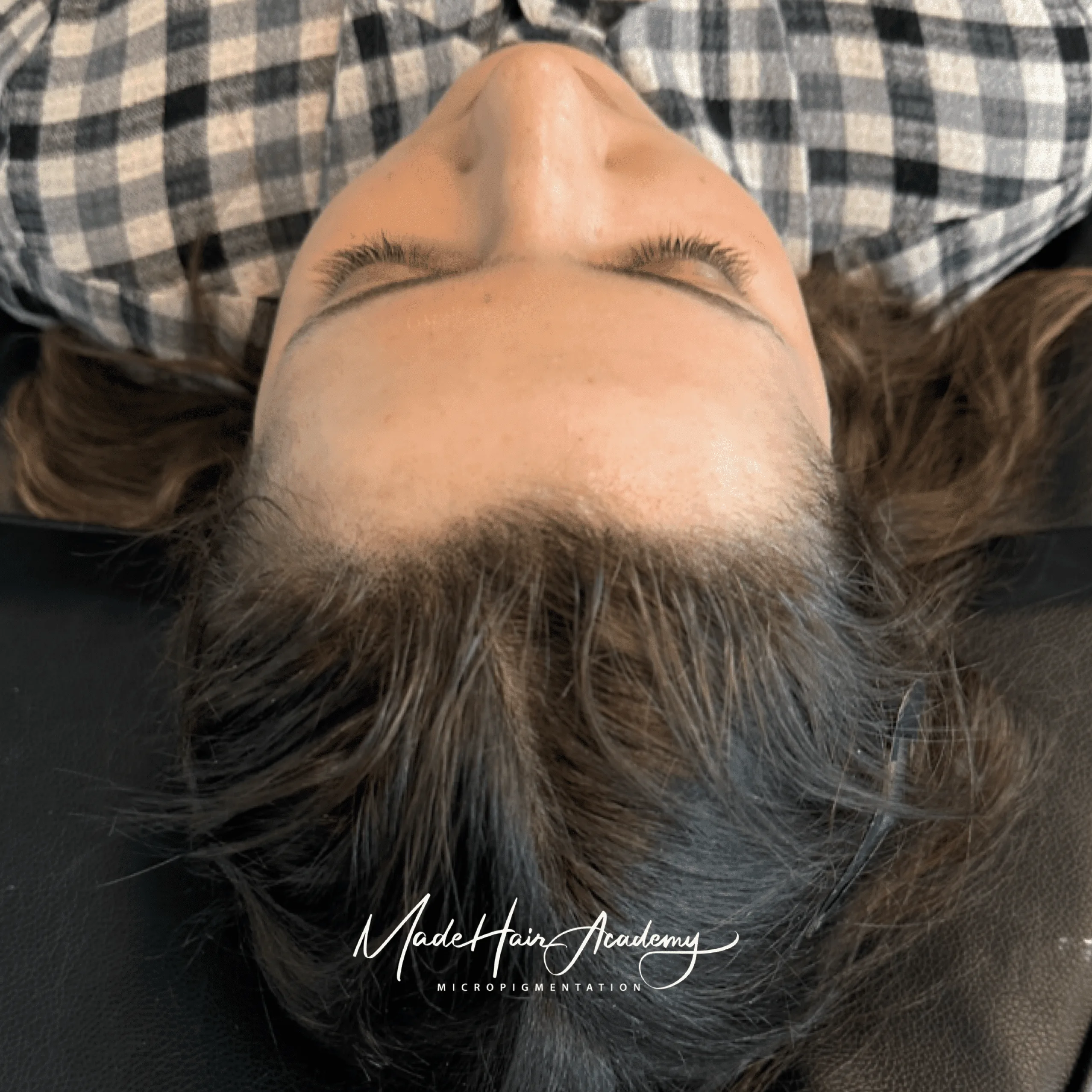 Scalp Micropigmentation, Hårpigmentering - Hårutfyllnad på kvinna, 28 år, i Göteborg – Naturligt resultat från Made Hair Academy.