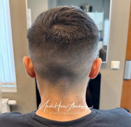 Diskret hårpigmentering för man 39 år i Stockholm utförd av Made Hair Academy – ledande klinik för diskret hårtatuering i Sverige