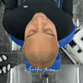 Scalp Micropigmentation för män Hårpigmentering för man 39 år i Stockholm utförd av Made Hair Academy – ledande klinik inom hårpigmentering i Sverige