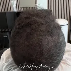 SMP hår Scalp Micropigmentation på man, 43 år, i Stockholm – Naturligt resultat från Made Hair Academy.