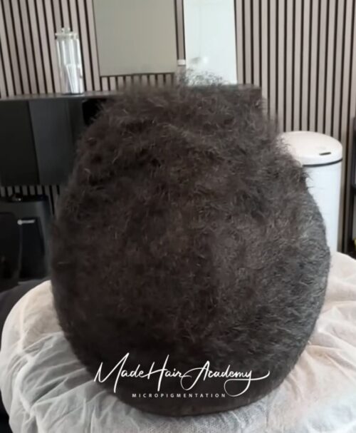 Scalp Micropigmentation på man, 43 år, i Stockholm – Naturligt resultat från Made Hair Academy.