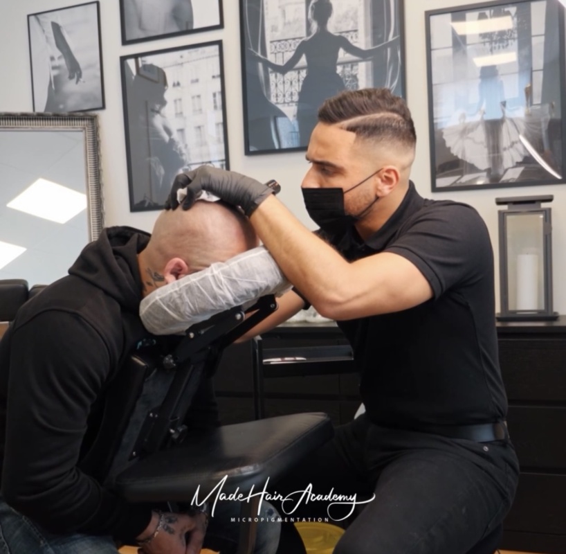 Scalp Micropigmentation | Behandling Mot Tunnhårighet