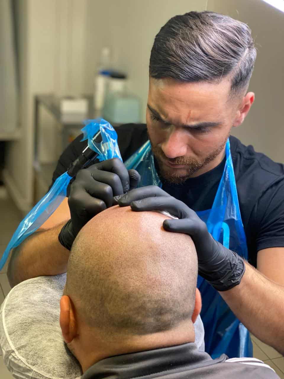 Scalp micropigmentation utförs i hårbotten hos Made Hair Academy