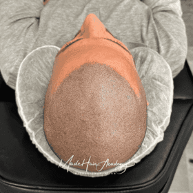 Hårpigmentering priser göteborg och stockholmm