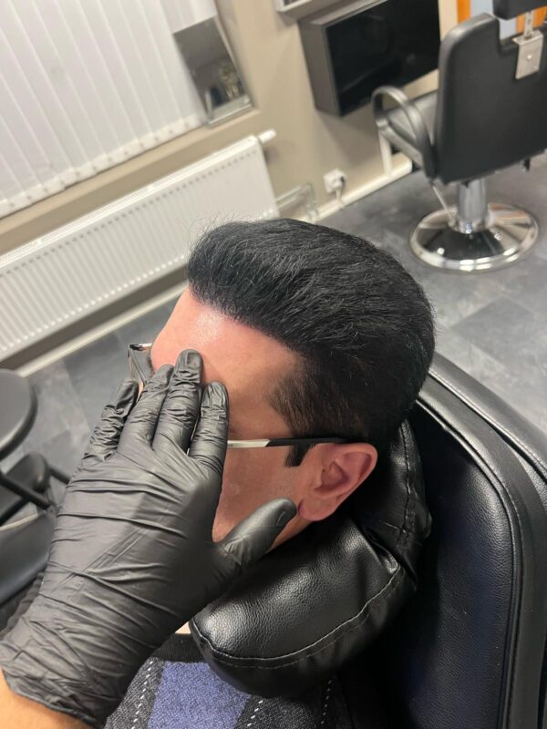 Scalp Micropigmentation by Made Hair Academy
