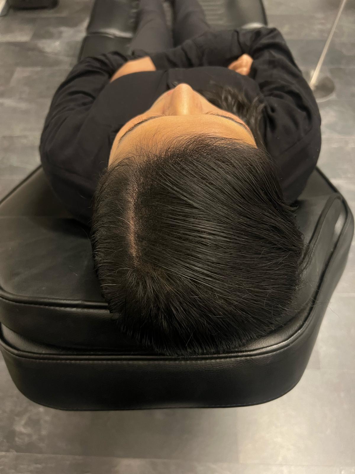 Scalp Micropigmentation by Made Hair Academy