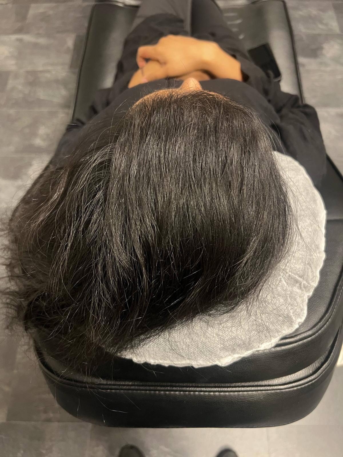 Scalp Micropigmentation by Made Hair Academy