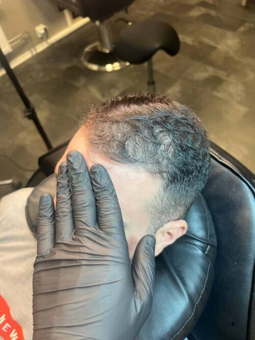 Hårtattoo på man, 44 år, utförd hos Made Hair Academy Malmö – specialist på diskret hårpigmentering i Sverige