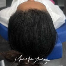 Hårpigmentering på kvinna, 34 år, utförd hos Made Hair Academy Stockholm – klinik med spetskompetens inom SMP i Sverige