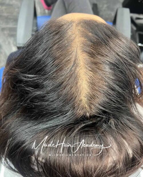 Hårpigmentering på kvinna, 34 år, utförd hos Made Hair Academy Göteborg – ledande studio inom hårpigmentering i Sverige