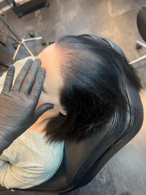 Hårpigmentering på kvinna, 42 år, utförd hos Made Hair Academy Stockholm – professionell behandling inom hårtatuering i Sverige