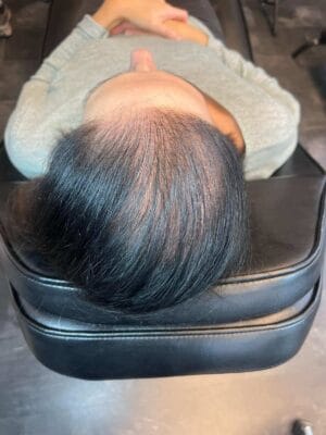 Hårpigmentering på kvinna, 47 år, utförd hos Made Hair Academy Göteborg – erfaren studio inom hårpigmentering i Sverige