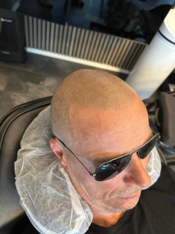 Hårpigmentering på man, 36 år, utförd hos Made Hair Academy Stockholm – etablerad studio för diskret hårtatuering i Sverige