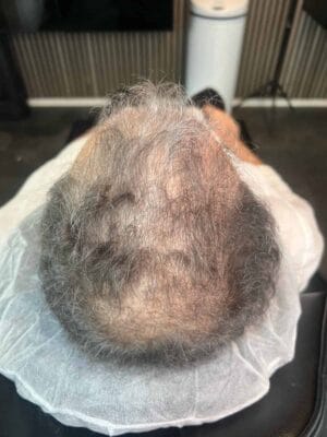 Hårpigmentering på man, 36 år, utförd hos Made Hair Academy Stockholm – specialist på diskret hårpigmentering i Sverige