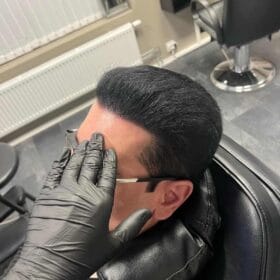 Hårpigmentering på man, 37 år, utförd hos Made Hair Academy Göteborg – ledande klinik för diskret SMP i Sverige