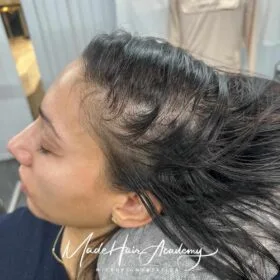 Scalp Micropigmentation på kvinna, 38 år, utförd hos Made Hair Academy Göteborg– Sveriges mest erfarna inom SMP för kvinnor