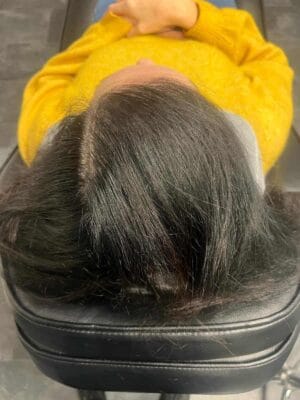 Scalp micropigmentation på kvinna, 38 år, utförd hos Made Hair Academy Stockholm – specialist inom SMP för kvinnor i Sverige