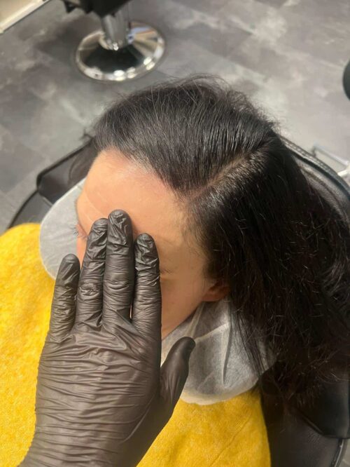 Scalp micropigmentation på kvinna, 42 år, utförd hos Made Hair Academy Göteborg – ledande aktör inom kvinnlig scalp micropigmentation i Sverige