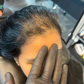 Scalp micropigmentation på kvinna, 42 år, utförd hos Made Hair Academy Stockholm – ledande studio inom kvinnlig SMP i Sverige