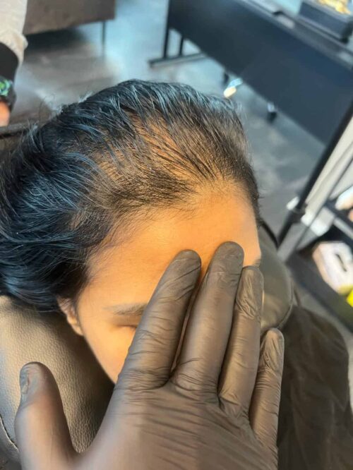 Scalp micropigmentation på kvinna, 42 år, utförd hos Made Hair Academy Stockholm – ledande studio inom kvinnlig SMP i Sverige