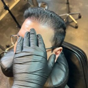 Scalp micropigmentation på man, 36 år, utförd hos Made Hair Academy Göteborg – specialist på SMP för män i Sverige