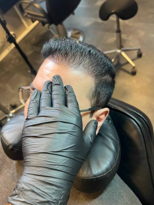 Scalp micropigmentation på man, 36 år, utförd hos Made Hair Academy Göteborg – specialist på SMP för män i Sverige