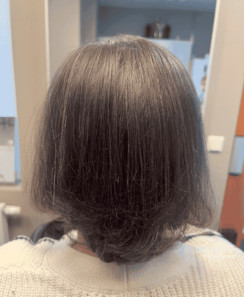 Hårpigmentering på kvinna, 30 år, utförd hos Made Hair Academy Stockholm – ledande klinik för hårtatuering i Sverige