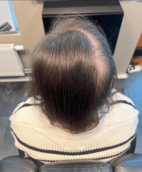 Hårpigmentering på kvinna, 30 år, utförd hos Made Hair Academy Göteborg – etablerad expert på hårpigmentering i Sverige