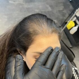 Hårpigmentering på kvinna, 34 år, utförd hos Made Hair Academy Göteborg – ledande studio för hårtatuering i Sverige