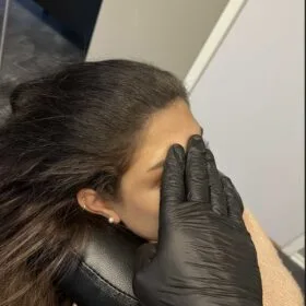 Alopecia behandlingar med scalp micropigmentering | Made Hair Academy – ledande klinik för diskret hårtatuering i Sverige