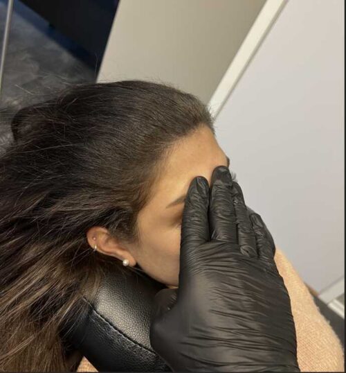 Alopecia behandlingar med scalp micropigmentering | Made Hair Academy – ledande klinik för diskret hårtatuering i Sverige