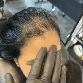 SMP Kvinna Scalp micropigmentation kvinnor. 30 år, utförd hos Made Hair Academy Göteborg – ledande inom naturlig pigmentering i Sverige