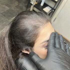 Scalp Micropigmentation på kvinna, 34 år, utförd hos Made Hair Academy Stockholm – specialist på SMP för kvinnor i Sverige