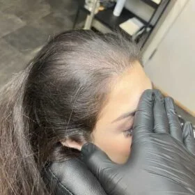 Scalp Micropigmentation på kvinna, 34 år, utförd hos Made Hair Academy Stockholm – specialist på SMP för kvinnor i Sverige