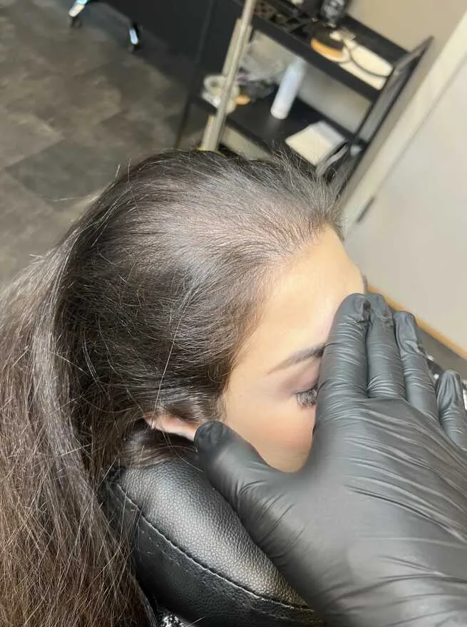 Scalp Micropigmentation på kvinna, 34 år, utförd hos Made Hair Academy Stockholm – specialist på SMP för kvinnor i Sverige