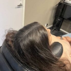 Håravfall | Hårutfyllnad kvinna mitten & hjässa Scalp Micropigmentation på kvinna, 34 år, utförd hos Made Hair Academy Stockholm– toppval inom scalp micropigmentation i Sverige